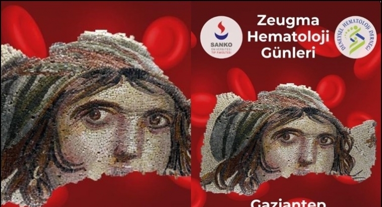 Gaziantep Zeugma Hematoloji Günleri...