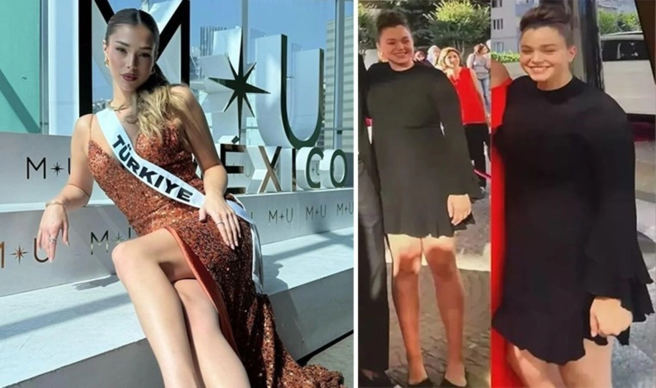 Miss Universe'de (Kainat Güzellik Yarışması) Türkiye'yi temsil etmişti: Eski halini paylaş