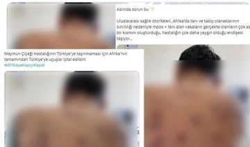 Cumhurbaşkanlığından 'maymun çiçeği' açıklaması: ' Sosyal medyadaki iddialar manipülasyon içermektedir'